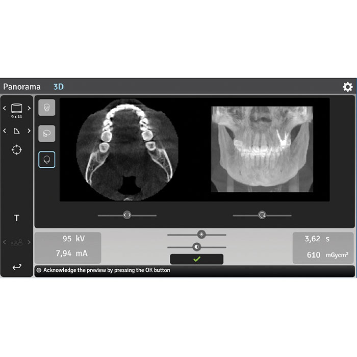 Dexis OP 3D - 9x11 FOV Ceph.