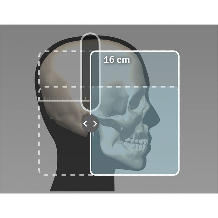 Dexis OP 3D - 9x11 FOV Ceph.