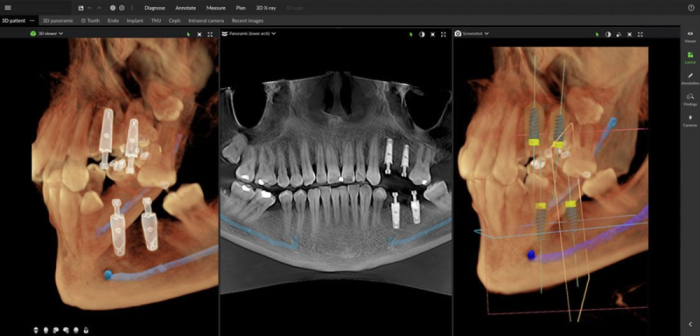 Dexis OP 3D™ LX 12x15 FOV Ceph. Dexis OP 3D™ LX 12x15 FOV Ceph.