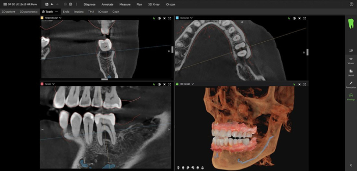 Dexis OP 3D™ LX 12x15 FOV Ceph. Dexis OP 3D™ LX 12x15 FOV Ceph.