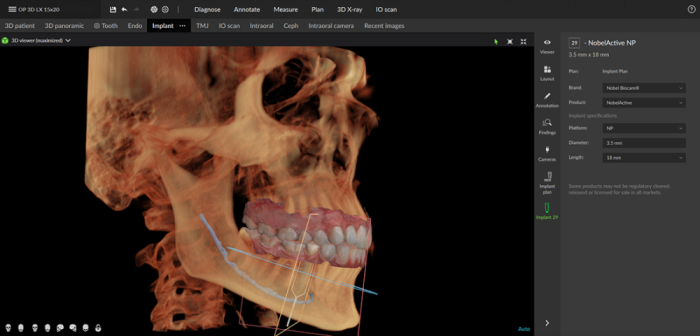 Dexis OP 3D™ LX 12x15 FOV Ceph. Dexis OP 3D™ LX 12x15 FOV Ceph.