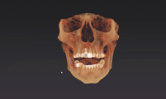 Dexis OP 3D™ LX 10x10 FOV Ceph. Dexis OP 3D™ LX 10x10 FOV Ceph.