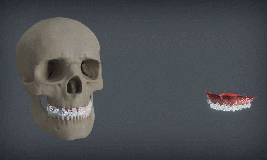 Dexis OP 3D™ LX 10x10 FOV Ceph. Dexis OP 3D™ LX 10x10 FOV Ceph.