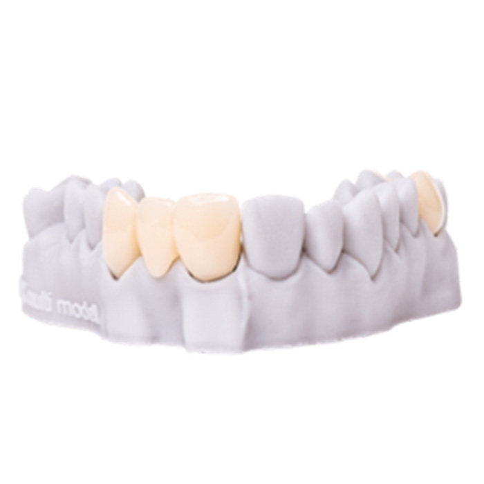 RS VIVO C&B Smile A1 - 500g RS VIVO C&B Smile A1 - 500g